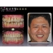 Periodontal Diseases Treatment