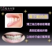 Dental Braces