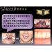 Segera Dental Implants