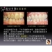 Rumah Teeth Whitening