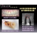 Root Recovery Canal