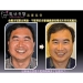 Laser Terapia Periodontal