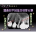 Trattamenti Root Canal