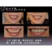 Dental Corrective Surgery